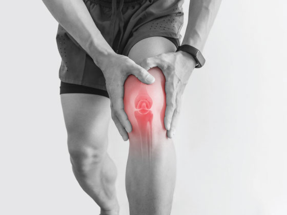 Rheumatoid Arthritis Treatment